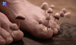 Terapia grzybicy paznokci z użyciem naturalnych metod Nexmed.