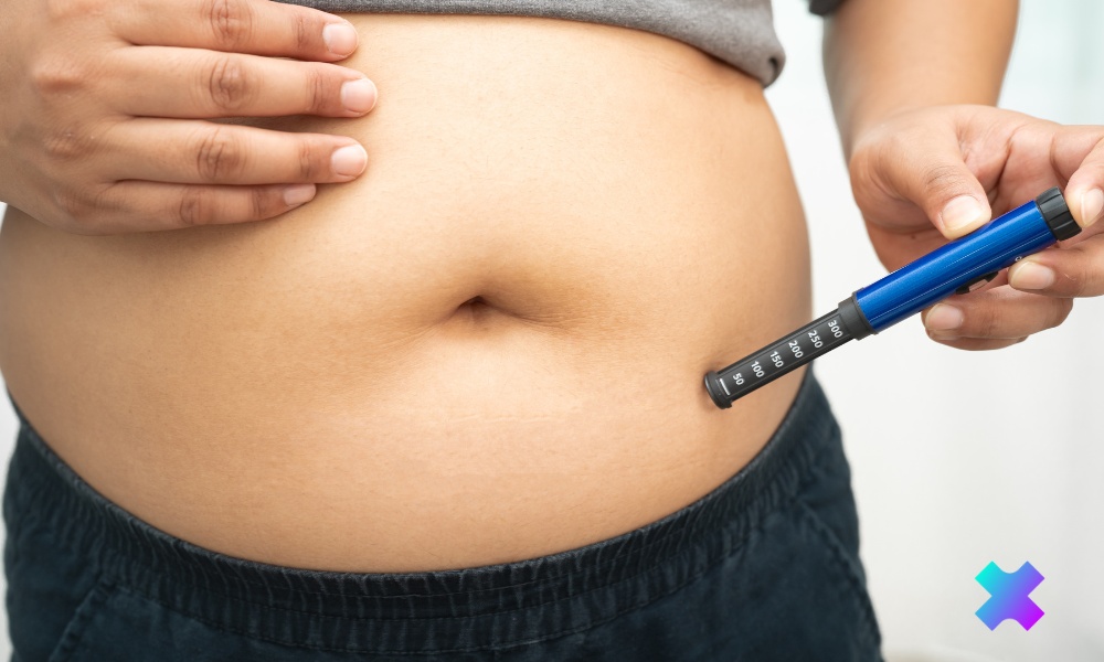 Farmakoterapia w leczeniu otyłości olbrzymiej