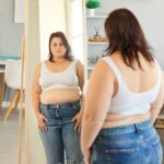 Otyłość olbrzymia - kiedy operacja a kiedy leki? bariatria-czy-farmakoterapia_top